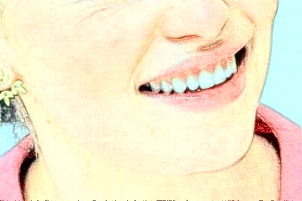 淮安諾貝爾口腔醫(yī)院隱形矯正怎么樣，附醫(yī)生信息一覽~