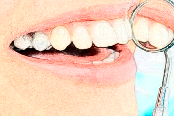 2024重慶齊美口腔門診部錯(cuò)位畸形固定怎么樣_專家信息_案例大全欣賞