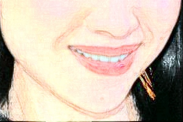 重慶團(tuán)圓口腔醫(yī)院拔智齒價(jià)格?拔智齒好處和壞處