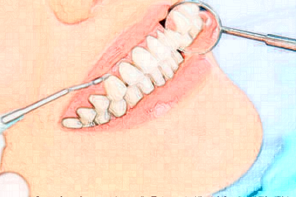 義烏傅氏口腔門診部矯正牙齒好不好?矯正牙齒案例