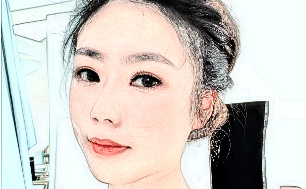 泉州豐澤西華醫(yī)療美容門診部玻尿酸去頸紋技術(shù)怎么樣?術(shù)后一年野生案例