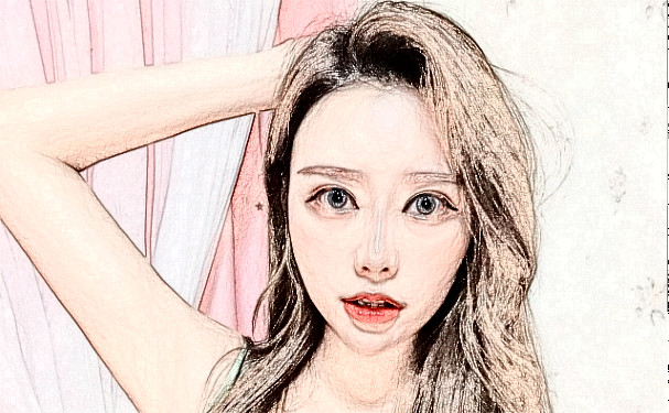 成都恒博天姿醫(yī)療美容門診部玻尿酸填充全臉90天案例欣賞|技術(shù)測(cè)評(píng)怎么樣?費(fèi)用多少