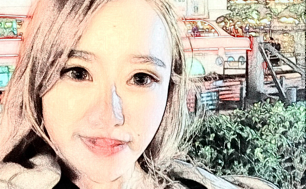 內(nèi)蒙古永泰醫(yī)院玻尿酸填充一般多少錢?120天案例欣賞