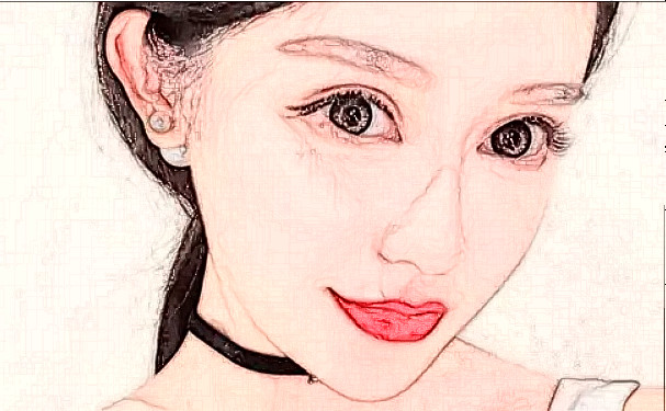 寧波鄞州唯格醫(yī)療美容門診部玻尿酸注射技術點評怎么樣?120天求美案例