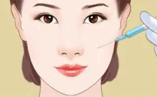 北京阿露絲醫(yī)療美容門診部玻尿酸填充技術怎么樣?術后三個月野生案例|收費多少