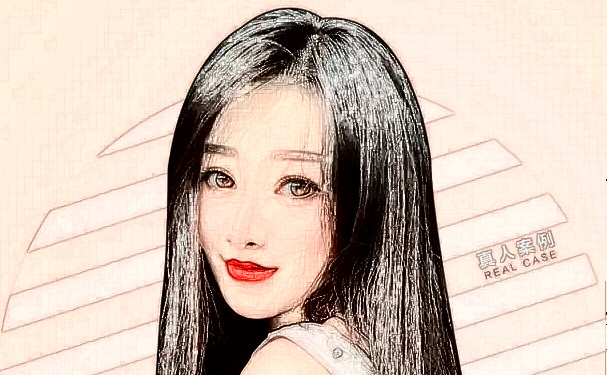 青島市南區(qū)諾美德醫(yī)學美容門診部打玻尿酸技術等級怎么樣?野生案例&價目一覽表