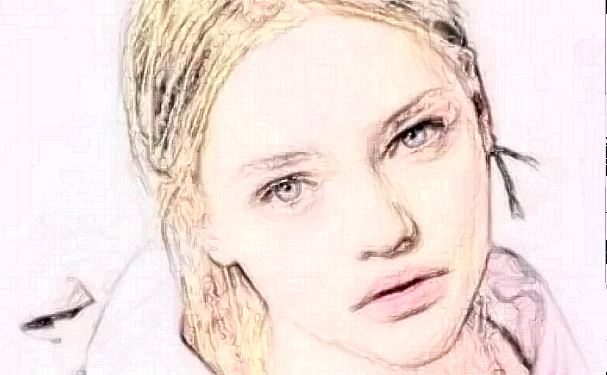 北京藝美碩德醫(yī)療美容診所射頻除皺技術級別怎么樣?術后三個月案例反饋