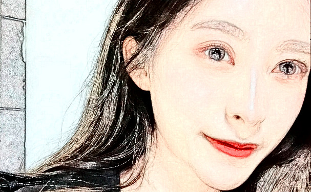 濟南愛容整形美容醫(yī)院玻尿酸填充下巴技術(shù)等級怎么樣?術(shù)后案例&一般多少錢