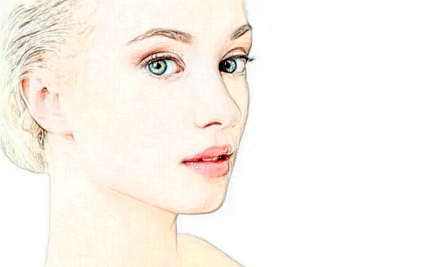 寧波米陽(yáng)整形醫(yī)院玻尿酸填充臉部術(shù)后半年求美案例|技術(shù)水準(zhǔn)怎么樣?價(jià)目一覽表