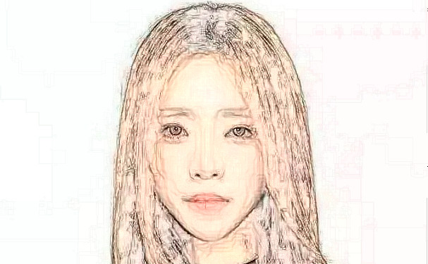 沈陽(yáng)和平藍(lán)天醫(yī)療美容門(mén)診部玻尿酸填充全臉費(fèi)用多少?技術(shù)亮點(diǎn)&術(shù)后半年求美案例