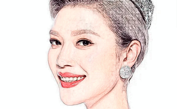 麗水黃君曼整形醫(yī)院去頸紋技術(shù)怎么樣?費(fèi)用查詢?半年親測案例全解