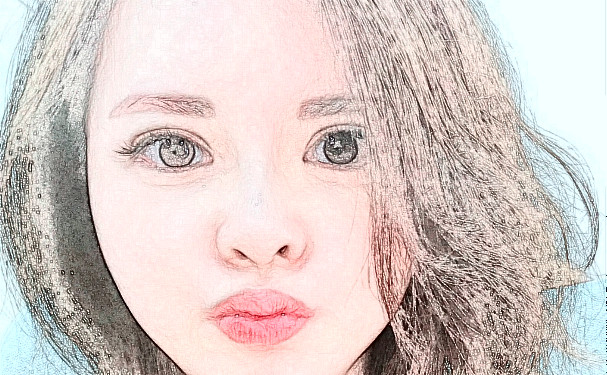 咸寧奧萊整形醫(yī)院除皺技術(shù)怎么樣?收費(fèi)標(biāo)準(zhǔn)?90天案例曝光