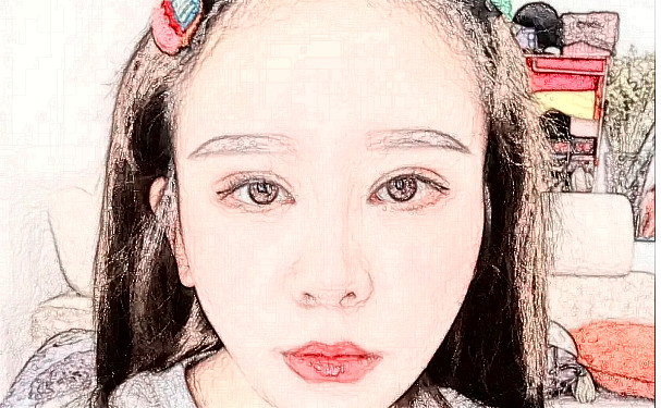 長沙麗臻醫(yī)療美容門診激光除皺技術(shù)等級(jí)怎么樣?術(shù)后90天案例&價(jià)格