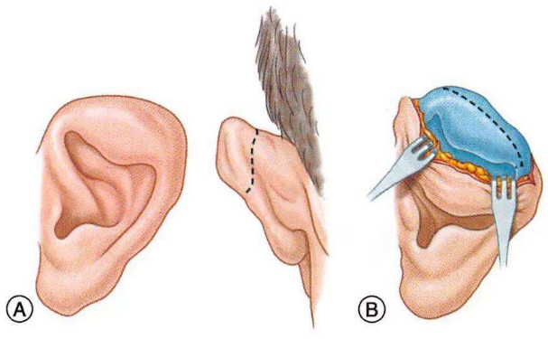 華中科技大學(xué)同濟(jì)醫(yī)學(xué)院醫(yī)院杯狀耳整形價格一覽表?技術(shù)風(fēng)格怎么樣?