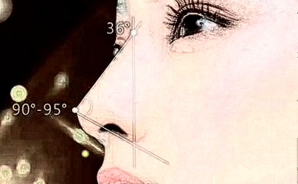 深圳港丹醫(yī)療美容門診部膨體隆鼻收費多少?120天恢復案例