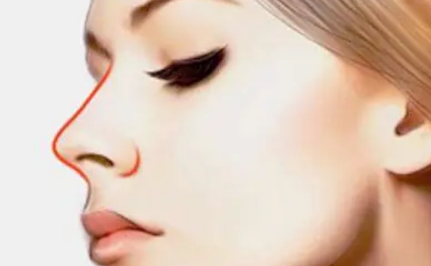 深圳太美整容醫(yī)院門診部隆鼻價(jià)目表?技術(shù)評(píng)測怎么樣?