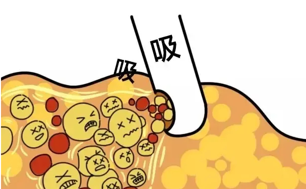 天津和諧同方醫(yī)療美容隆胸技術怎么樣?費用明細?術后三個月恢復案例