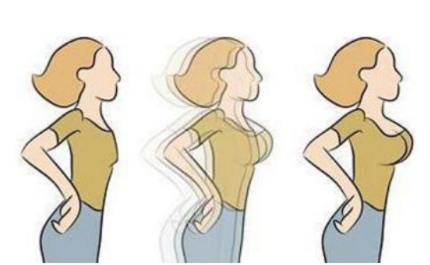 成都武侯美黎美醫(yī)療美容門診部假體隆胸技術怎么樣?術后一年案例欣賞