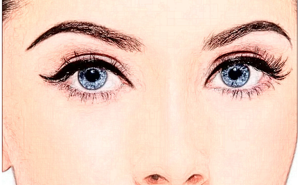 邵陽(yáng)曹家醫(yī)療美容門診部雙眼皮技術(shù)怎么樣?價(jià)格?術(shù)后半年案例