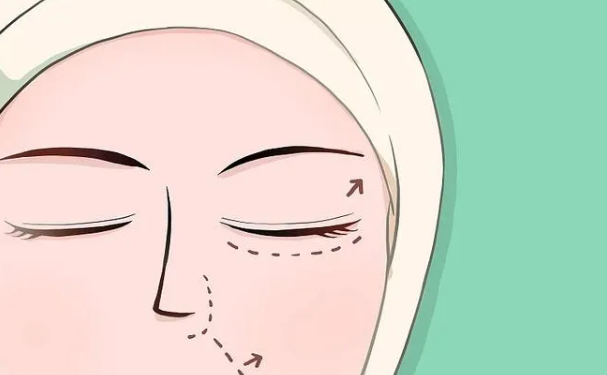 沈陽(yáng)碧航醫(yī)療診所定點(diǎn)雙眼皮半年術(shù)后案例反饋&技術(shù)怎么樣?