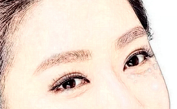 上海天大醫(yī)療美容醫(yī)院雙眼皮怎么樣?價(jià)格明細(xì)?案例欣賞&技術(shù)亮點(diǎn)