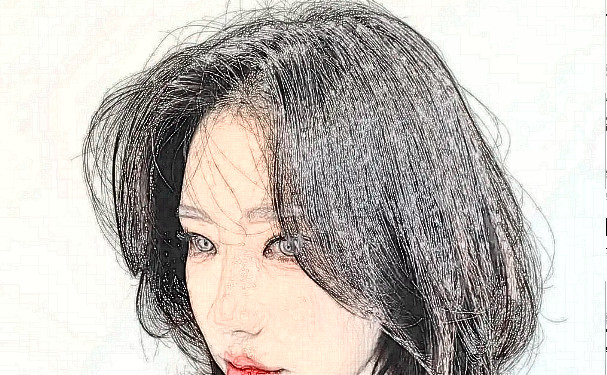 南寧農(nóng)霖整形醫(yī)院植發(fā)技術(shù)怎么樣?術(shù)后三個月案例點評