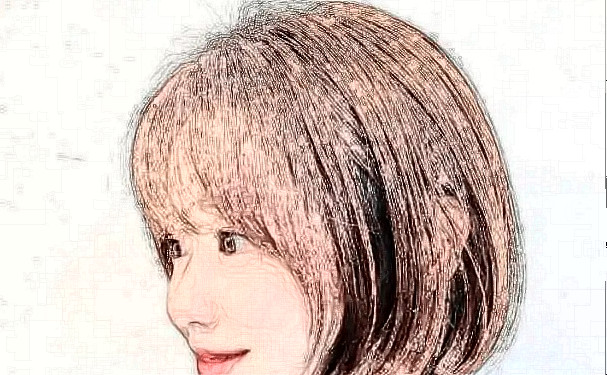 寧波尚麗整形醫(yī)院植發(fā)技術(shù)怎么樣?120天術(shù)后恢復案例