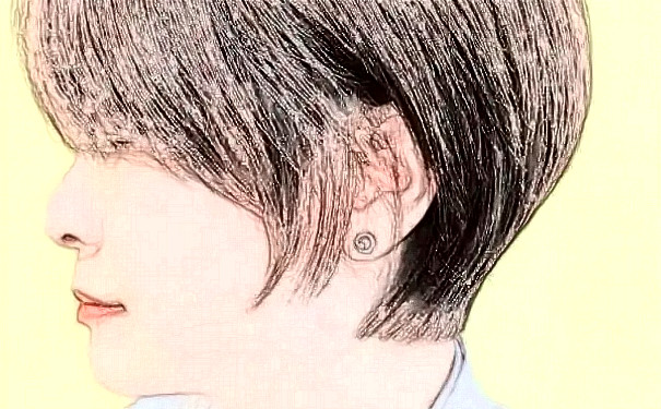 上海葦渡醫(yī)療 PherriMed植發(fā)技術(shù)怎么樣?多少錢?心動(dòng)案例