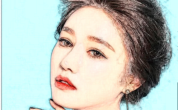 武漢碧蓮盛醫(yī)療美容門診部頭發(fā)種植術(shù)后三個月經(jīng)典案例(效果怎么樣?技術(shù)評價)