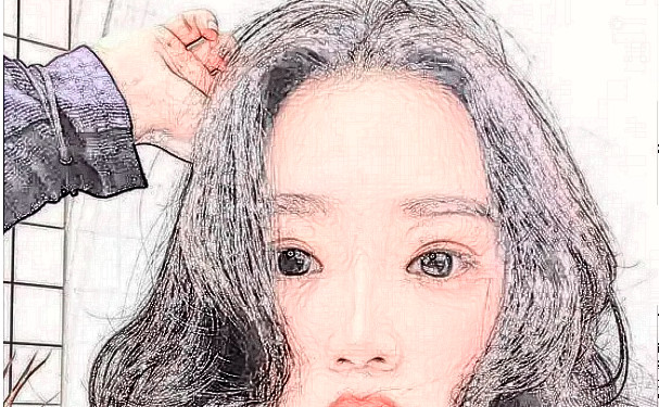 武漢希思特醫(yī)療美容醫(yī)院植發(fā)技術(shù)評(píng)價(jià)怎么樣?一年案例恢復(fù)過(guò)程