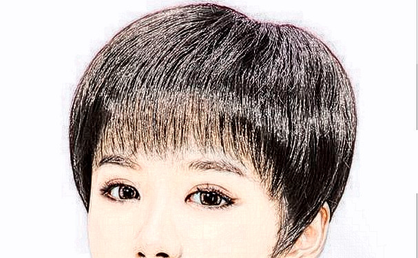 碧蓮盛美學(xué)植發(fā)（寧波分院）植發(fā)120天野生案例|技術(shù)評價(jià)怎么樣?價(jià)格查詢