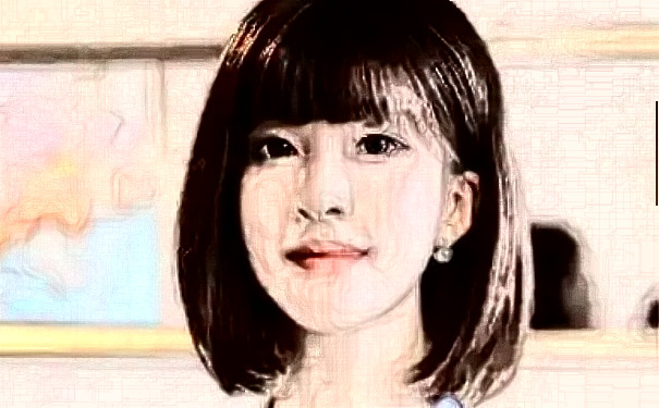 菏澤華美醫(yī)療美容門診部植發(fā)120天求美案例|技術(shù)評價(jià)怎么樣?價(jià)目一覽表