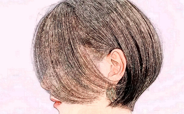 深圳陽(yáng)光整形美容醫(yī)院植發(fā)價(jià)目一覽表?技術(shù)點(diǎn)評(píng)&90天求美案例