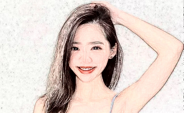 天津河西坤如瑪麗婦產(chǎn)醫(yī)院種植頭發(fā)術(shù)后一年經(jīng)典案例&技術(shù)怎么樣?