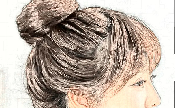 河南江禾醫(yī)療整形植發(fā)技術(shù)評(píng)測(cè)怎么樣?術(shù)后半年案例曝光