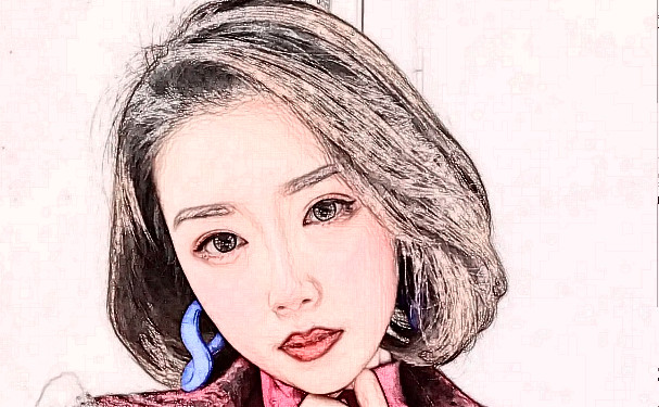 江西美皇整形醫(yī)院脂肪填充整形術后一年野生案例&技術怎么樣?