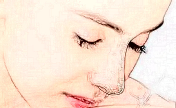 北京東方和諧醫(yī)療美容診所脂肪填充術后半年案例揭秘&技術怎么樣?