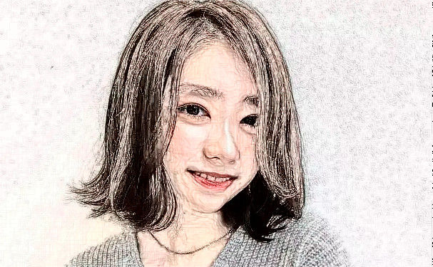 北京東方和諧醫(yī)療美容診所脂肪填充術后半年案例揭秘&技術怎么樣?