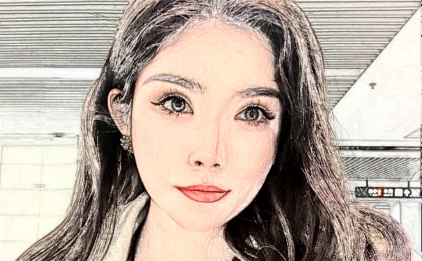 烏魯木齊花之妍醫(yī)療美容整形醫(yī)院脂肪填充三個月術(shù)后恢復(fù)案例&技術(shù)怎么樣?