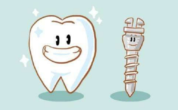 北京天壇醫(yī)院白保晶種植牙技術(shù)優(yōu)勢怎么樣?經(jīng)驗(yàn)案例