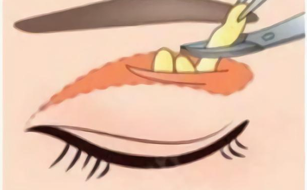 武漢兒童醫(yī)院雙眼皮需要多少錢?求美案例,醫(yī)院簡(jiǎn)介