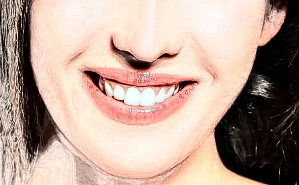 杭州口腔醫(yī)院范豐燕牙齒矯正技術(shù)怎么樣?需要多少錢?效果詳情