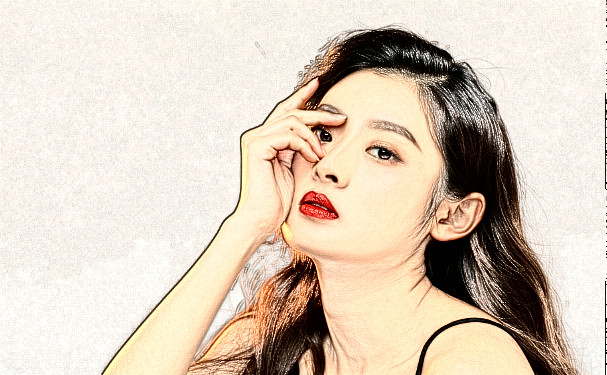 河北醫(yī)科大學(xué)第二醫(yī)院玻尿酸注射淚溝技術(shù)怎么樣?收費標準?野生案例