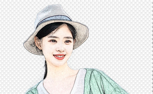 河北醫(yī)科大學(xué)第二醫(yī)院玻尿酸注射淚溝技術(shù)怎么樣?收費標準?野生案例