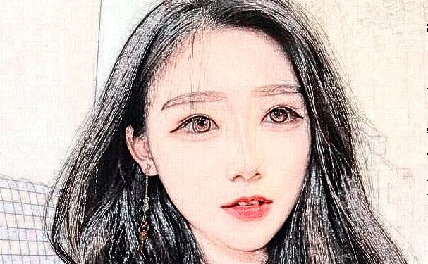 運城市中心醫(yī)院岳長路太陽凹陷整形手術(shù)術(shù)后案例&價格明細?