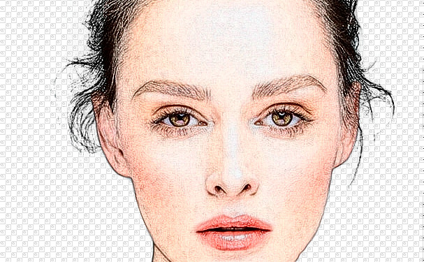 運城市中心醫(yī)院岳長路太陽凹陷整形手術(shù)術(shù)后案例&價格明細?