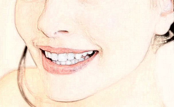 暨南大學附屬口腔醫(yī)院種植牙價格查詢?技術點評_口碑詳情