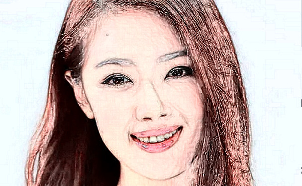 臨沂市人民醫(yī)院李玉柱激光美容祛斑價(jià)格明細(xì)?術(shù)后6個(gè)月案例,醫(yī)生介紹