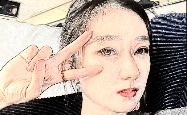 八大處整形醫(yī)院李川燒傷疤痕修復求美案例&費用多少?