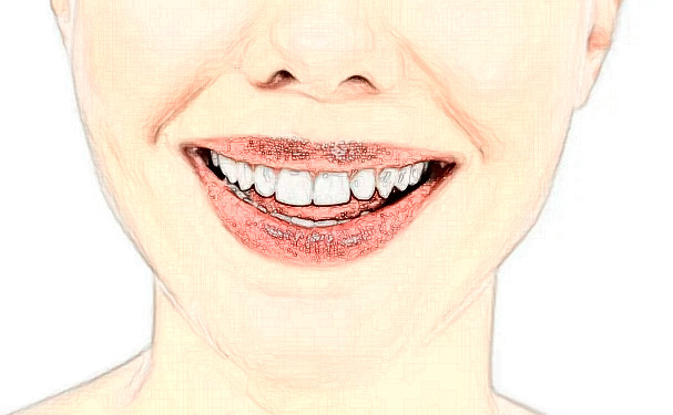 北京同仁醫(yī)院南區(qū)牙齒正畸案例細(xì)節(jié)&多少錢?